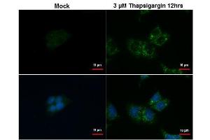 ICC/IF Image SQSTM1 antibody [N3C1], Internal detects SQSTM1 protein at autophagosome by immunofluorescent analysis.