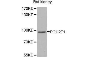 Western blot analysis of extracts of various cell lines, using POU2F1 antibody. (POU2F1 antibody  (AA 15-290))