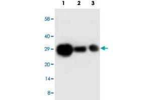 Western blot analysis of TIMP1 recombinant protein with TIMP1 polyclonal antibody . (TIMP1 antibody  (C-Term))