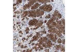 Immunohistochemical staining of human stomach with ADNP2 polyclonal antibody  shows strong cytoplasmic positivity in glandular cells at 1:20-1:50 dilution. (ADNP2 antibody)