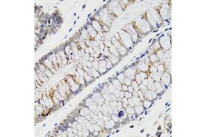 Immunohistochemistry of paraffin-embedded human rectum using CHMP4B antibody (ABIN5975521) at dilution of 1/100 (40x lens). (CHMP4B antibody)