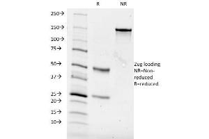 SDS-PAGE Analysis Purified CD84 Mouse Monoclonal Antibody (153-4D9). (CD84 antibody)