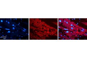 Rabbit Anti-PCCA Antibody   Formalin Fixed Paraffin Embedded Tissue: Human heart Tissue Observed Staining: Cytoplasmic Primary Antibody Concentration: N/A Other Working Concentrations: 1:600 Secondary Antibody: Donkey anti-Rabbit-Cy3 Secondary Antibody Concentration: 1:200 Magnification: 20X Exposure Time: 0. (PCCA antibody  (N-Term))