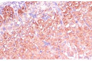 Immunohistochemistry of paraffin-embedded Mouse adrenal gland using CYP11B2 Polyclonal Antibody at dilution of 1:100 (40x lens). (CYP11B2 antibody)