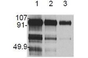 Western Blotting (WB) image for anti-Hepatocyte Growth Factor (Hepapoietin A, Scatter Factor) (HGF) antibody (ABIN492557) (HGF antibody)