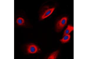 Immunofluorescent analysis of PTP1B staining in SKNSH cells. (PTPN1 antibody  (N-Term))