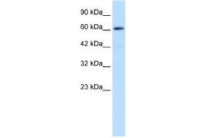WB Suggested Anti-ZNF499 Antibody Titration: 0.