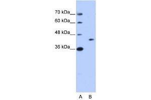GIPC1 antibody used at 1 ug/ml to detect target protein. (GIPC1 antibody  (N-Term))