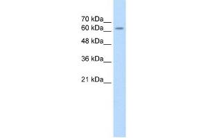 SARDH antibody used at 2. (SARDH antibody  (Middle Region))