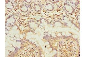 Immunohistochemistry of paraffin-embedded human small intestine tissue using ABIN7173950 at dilution of 1:100 (Type 2 Phosphatidylinositol 4,5-Bisphosphate 4-Phosphatase (PIP4P2) (AA 1-191) antibody)