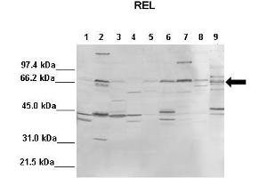 WB Suggested Anti-REL Antibody  Positive Control: Lane1: 100ug mouse liver, Lane2: 100ug mouse brain, Lane3: 100ug mouse heart, Lane4: 100ug mouse kidney, Lane5: 100ug mouse lung, Lane6: 100ug mouse thymus, Lane7: 100ug mouse spleen, Lane8: 100ug mouse testis, Lane9: 100ug mouse HeLa  Primary Antibody Dilution :  1:1000 Secondary Antibody :  Anti-rabbit-AP  Secondry Antibody Dilution :  1:10,000 Submitted by: Andreia Carvalho, Instituto de Biologia Molecular e Celular, Universidade do Porto (IBMC-UP) (c-Rel antibody  (Middle Region))