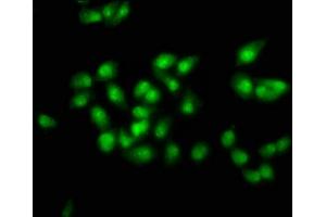Immunofluorescence staining of ntera-2 cells with ABIN7172619 at 1:100, counter-stained with DAPI. (SOX21 antibody  (AA 25-126))