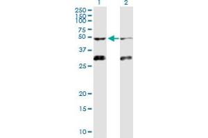 Western Blot analysis of ACVR1B expression in transfected 293T cell line by ACVR1B MaxPab polyclonal antibody. (Activin A Receptor Type IB/ALK-4 antibody  (AA 1-505))