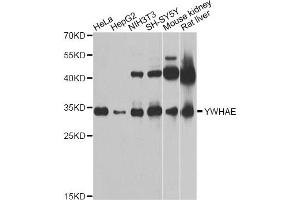 Western blot analysis of extracts of various cell lines, using YWHAE Antibody (ABIN5970417) at 1/1000 dilution. (YWHAE antibody)