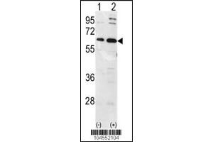 Western blot analysis of Ubiquilin1 using Ubiquilin1 Antibody using 293 cell lysates (2 ug/lane) either nontransfected (Lane 1) or transiently transfected with the Ubiquilin1 gene (Lane 2).