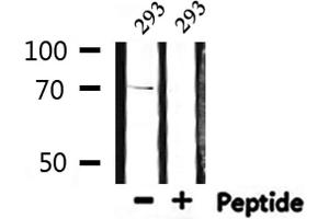Western blot analysis of extracts from 293, using S6K Antibody. (RPS6KB1 antibody  (C-Term))
