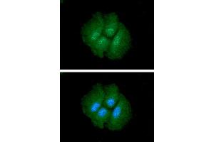 ICC/IF analysis of CTGF in Hep3B cells. (CTGF antibody  (AA 27-349))