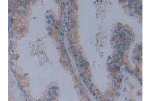 Immunohistochemistry (IHC) image for anti-Fibrillin 1 (FBN1) (AA 246-389) antibody (ABIN7438742)
