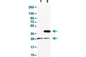 Western Blot analysis with CD1E polyclonal antibody . (CD1e antibody  (AA 79-147))