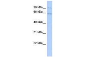 Image no. 1 for anti-Zinc Finger Protein 319 (ZNF319) (AA 35-84) antibody (ABIN6743566) (ZNF319 antibody  (AA 35-84))