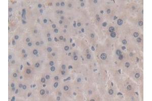 #VALUE! (APOA5 antibody  (AA 21-210))