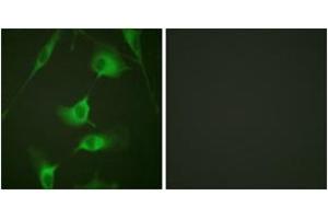 Immunofluorescence analysis of HeLa cells, using Keratin 8 (Ab-431) Antibody. (KRT8 antibody  (AA 401-450))