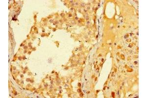 Immunohistochemistry of paraffin-embedded human testis tissue using ABIN7176667 at dilution of 1:100 (ELAC1 antibody  (AA 1-363))