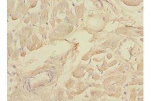 Immunohistochemistry of paraffin-embedded human heart tissue using ABIN7160069 at dilution of 1:100 (MAP4K3 antibody  (AA 755-894))