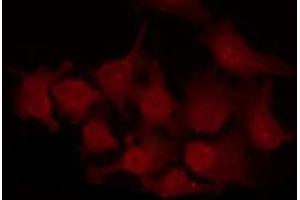 ABIN6269265 staining A2780 by IF/ICC. (CDKN1B antibody  (C-Term))