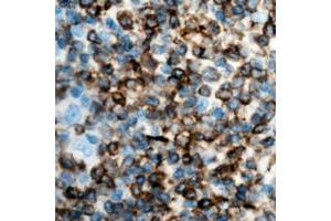 Immunohistochemical analysis of IFN gamma staining in human lymph node formalin fixed paraffin embedded tissue section. (Interferon gamma antibody  (Center))