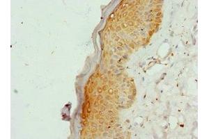 Immunohistochemistry of paraffin-embedded human skin tissue using ABIN7148255 at dilution of 1:100 (COL9A3 antibody  (AA 445-684))