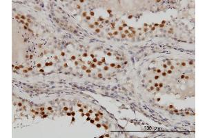 Immunoperoxidase of monoclonal antibody to RACGAP1 on formalin-fixed paraffin-embedded human testis.