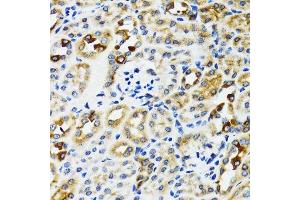Immunohistochemistry of paraffin-embedded rat kidney using RPN1 antibody.