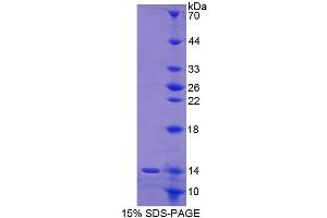 SDS-PAGE (SDS) image for Keratin 1 (KRT1) (AA 489-625) protein (His tag) (ABIN2121477)
