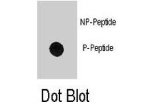 Dot blot analysis of MBP (phospho Y203) polyclonal antibody  on nitrocellulose membrane. (MBP antibody  (pTyr203))
