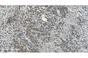 IHC analysis of NOX2/gp91phox/CYBB using anti-NOX2/gp91phox/CYBB antibody (ABIN7599875). (CYBB antibody  (AA 124-559))