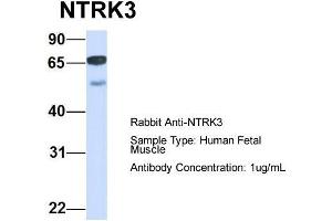 Host:  Rabbit  Target Name:  NTRK3  Sample Type:  Human Fetal Muscle  Antibody Dilution:  1. (NTRK3 antibody  (C-Term))