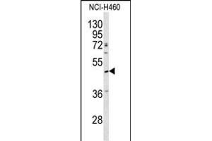 Western blot analysis of SERPINA4 antibody (C-term) (ABIN391661 and ABIN2841572) in NCI- cell line lysates (35 μg/lane). (SERPINA4 antibody  (C-Term))