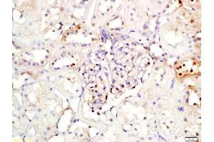 Formalin-fixed and paraffin embedded rat kidney labeled with Rabbit Anti-NFKBIA/IKB alpha Polyclonal Antibody, Unconjugated (ABIN674454) at 1:200 followed by conjugation to the secondary antibody and DAB staining (NFKBIA antibody  (AA 1-120))