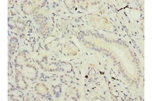 Immunohistochemistry of paraffin-embedded human pancreatic tissue using ABIN7171032 at dilution of 1:100 (SUSD4 antibody  (AA 56-290))