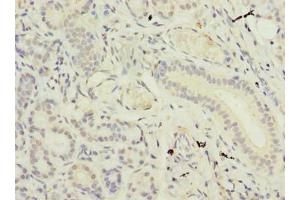 Immunohistochemistry of paraffin-embedded human pancreatic tissue using ABIN7171032 at dilution of 1:100 (SUSD4 antibody  (AA 56-290))