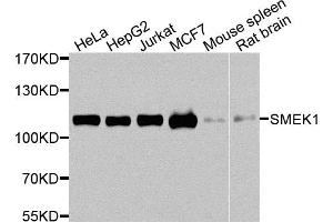 Western blot analysis of extracts of various cells, using SMEK1 antibody. (SMEK1 antibody)