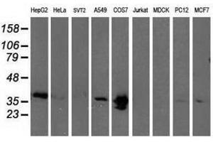 Image no. 2 for anti-Microtubule-Associated Protein, RP/EB Family, Member 2 (MAPRE2) antibody (ABIN1499320) (MAPRE2 antibody)
