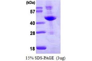 SDS-PAGE (SDS) image for Adenosine Deaminase (ADA) (AA 1-363) protein (His tag) (ABIN667926) (ADA Protein (AA 1-363) (His tag))