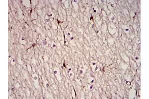 Immunohistochemical analysis of paraffin-embedded brain tissues using GFAP mouse mAb with DAB staining (GFAP antibody)