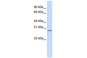 Image no. 1 for anti-Spleen Focus Forming Virus (SFFV) Proviral Integration Oncogene Spi1 (SPI1) (C-Term) antibody (ABIN6740536) (SPI1 antibody  (C-Term))