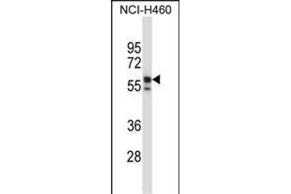 Keratin 6B antibody  (AA 207-236)