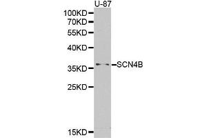 Western blot analysis of extracts of U-87 cell lines, using SCN4B antibody. (SCN4B antibody)