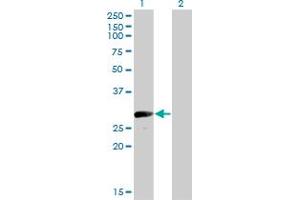 Western Blot analysis of VGLL1 expression in transfected 293T cell line by VGLL1 monoclonal antibody (M01), clone 3C7. (VGLL1 antibody  (AA 1-100))