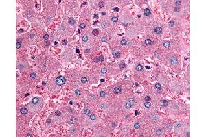 Immunohistochemical (Formalin/PFA-fixed paraffin-embedded sections) staining in human liver with DPP9 polyclonal antibody . (DPP9 antibody)